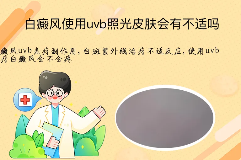 白癜风使用uvb照光皮肤会有不适吗