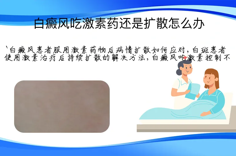 白癜风吃激素药还是扩散怎么办