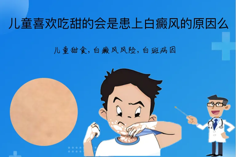 儿童喜欢吃甜的会是患上白癜风的原因么