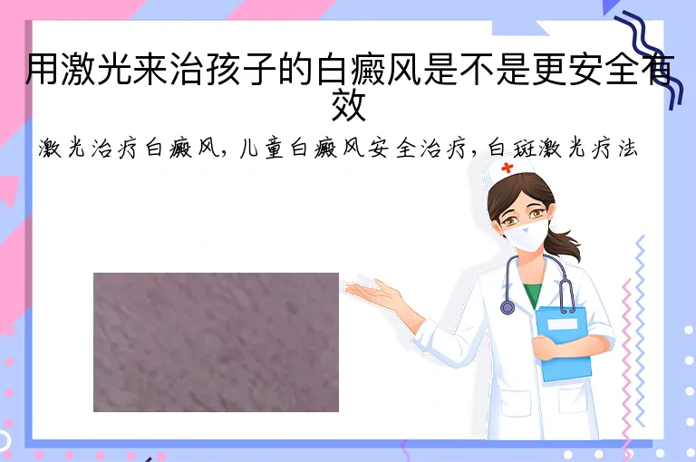 用激光来治孩子的白癜风是不是更安全有效