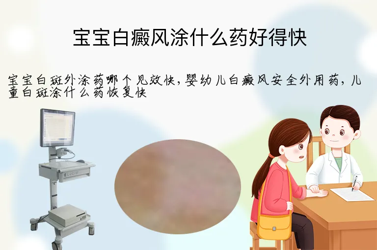 宝宝白癜风涂什么药好得快