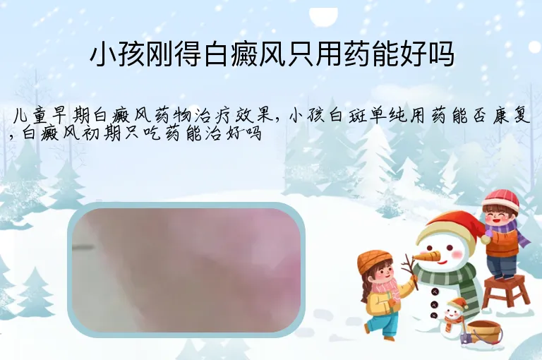小孩刚得白癜风只用药能好吗