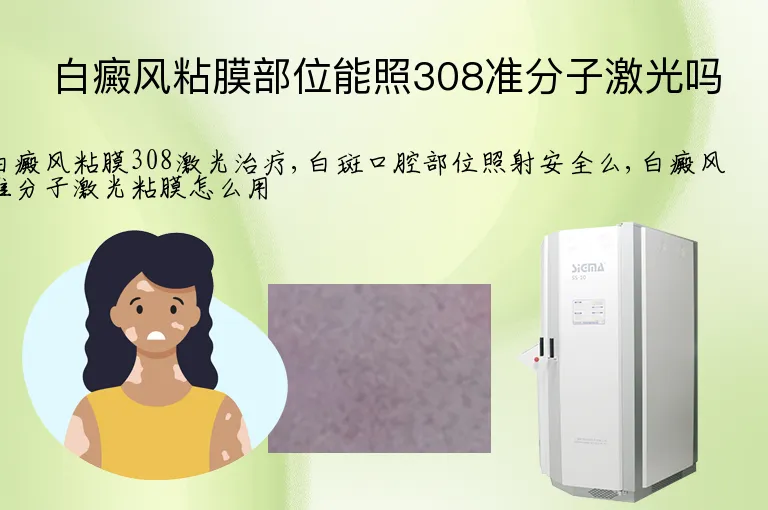白癜风粘膜部位能照308准分子激光吗