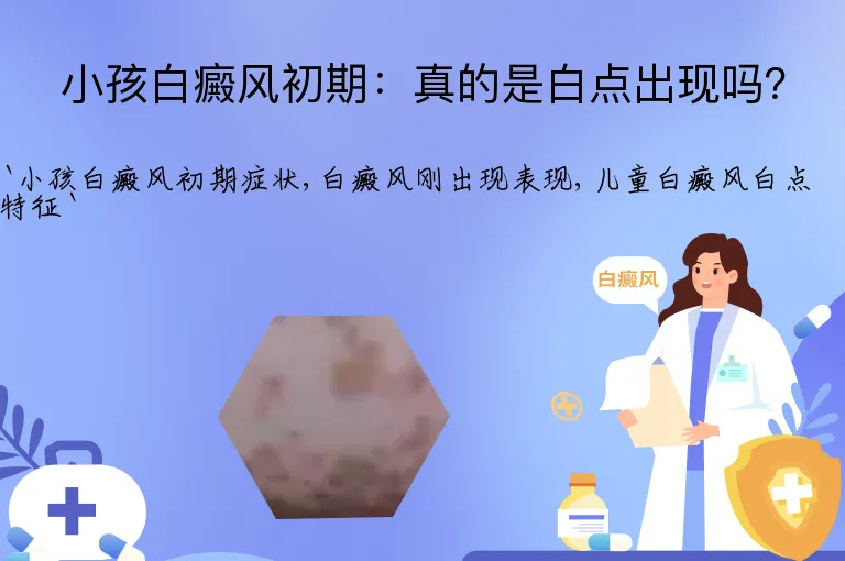 小孩白癜风初期：真的是白点出现吗？