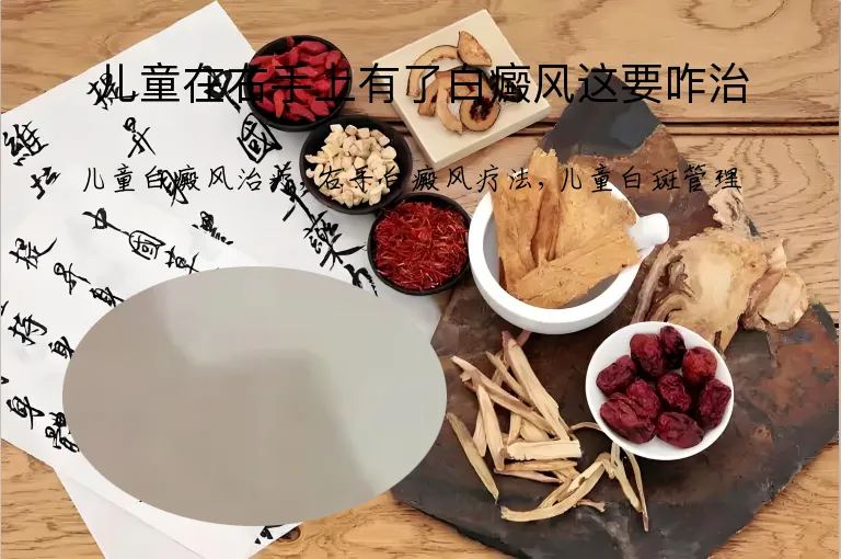 儿童在右手上有了白癜风这要咋治