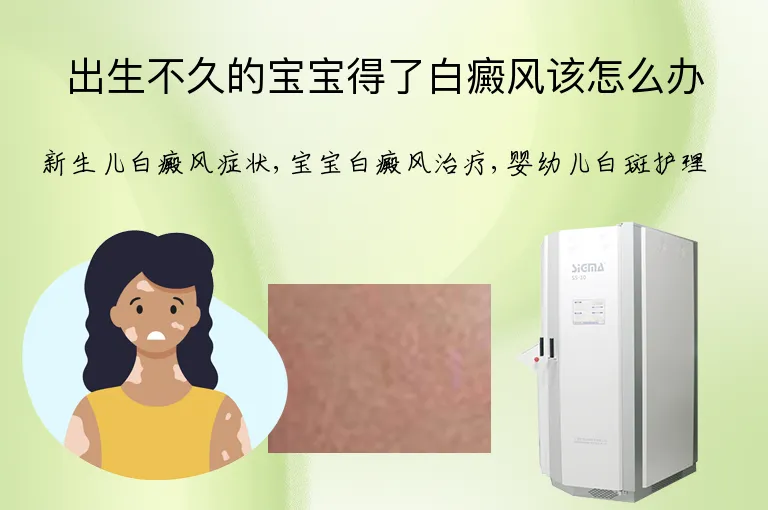 出生不久的宝宝得了白癜风该怎么办