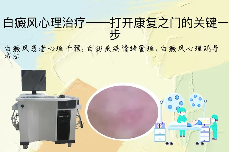 白癜风心理治疗——打开康复之门的关键一步