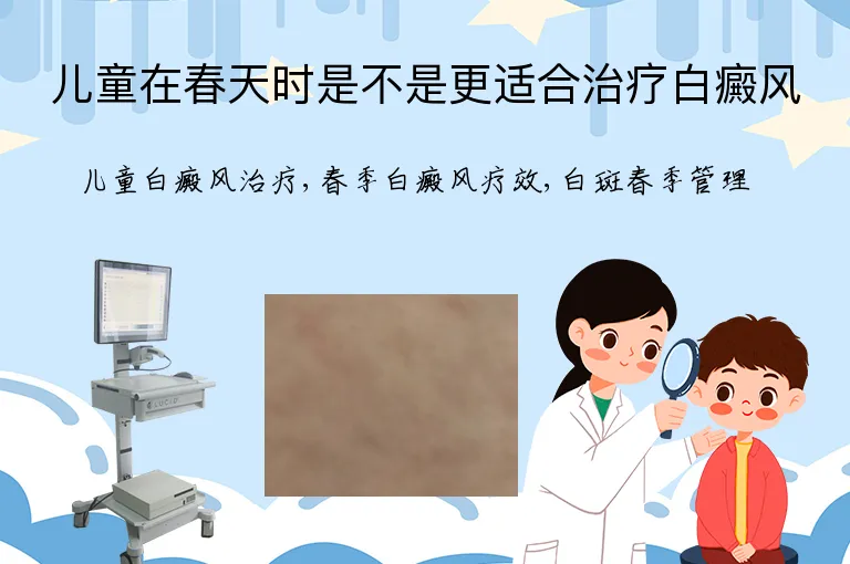 儿童在春天时是不是更适合治疗白癜风