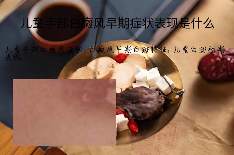 儿童手部白癜风早期症状表现是什么
