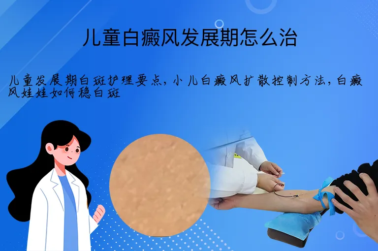 儿童白癜风发展期怎么治