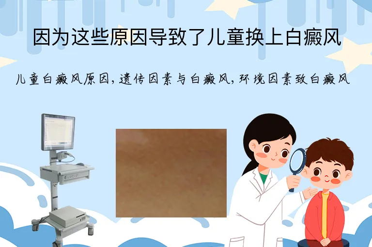 因为这些原因导致了儿童换上白癜风