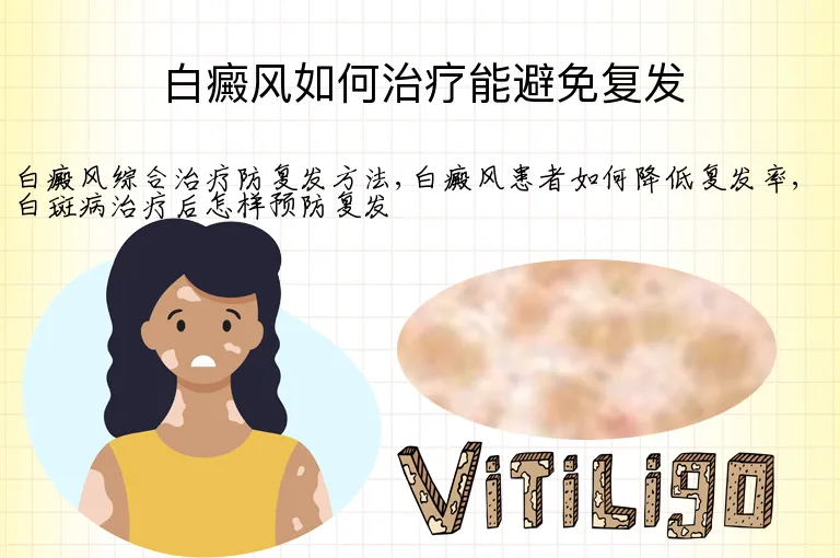 白癜风如何治疗能避免复发