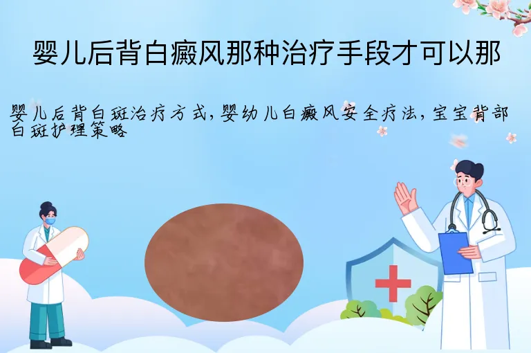 婴儿后背白癜风那种治疗手段才可以那