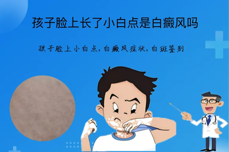 孩子脸上长了小白点是白癜风吗
