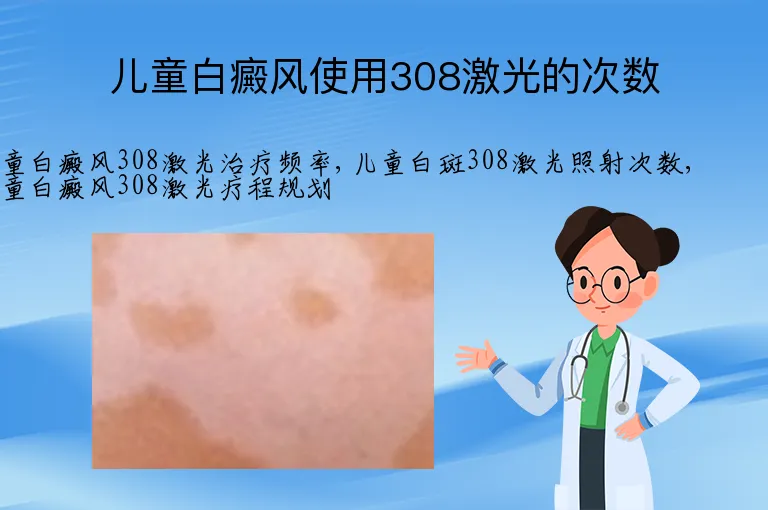 儿童白癜风使用308激光的次数