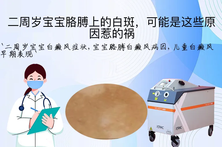 二周岁宝宝胳膊上的白斑，可能是这些原因惹的祸