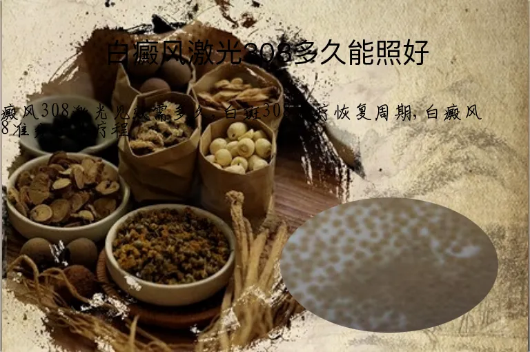 白癜风激光308多久能照好