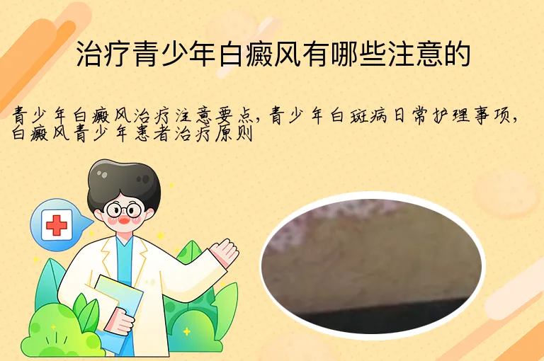 治疗青少年白癜风有哪些注意的