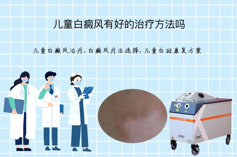 儿童白癜风有好的治疗方法吗