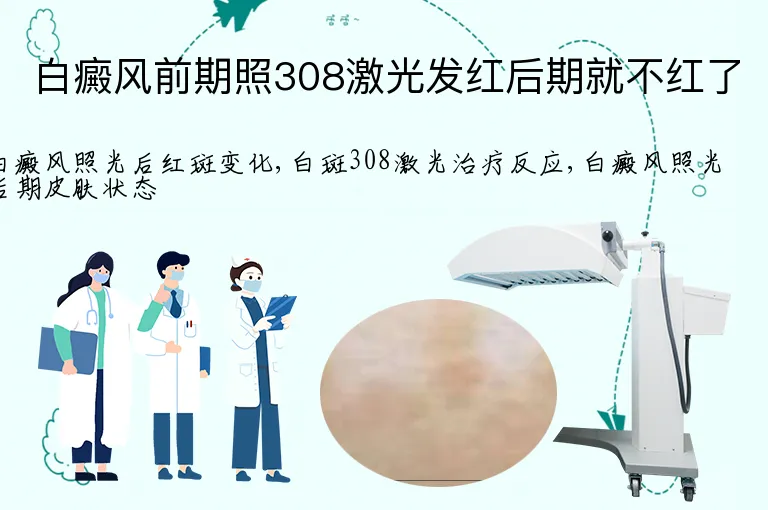 白癜风前期照308激光发红后期就不红了