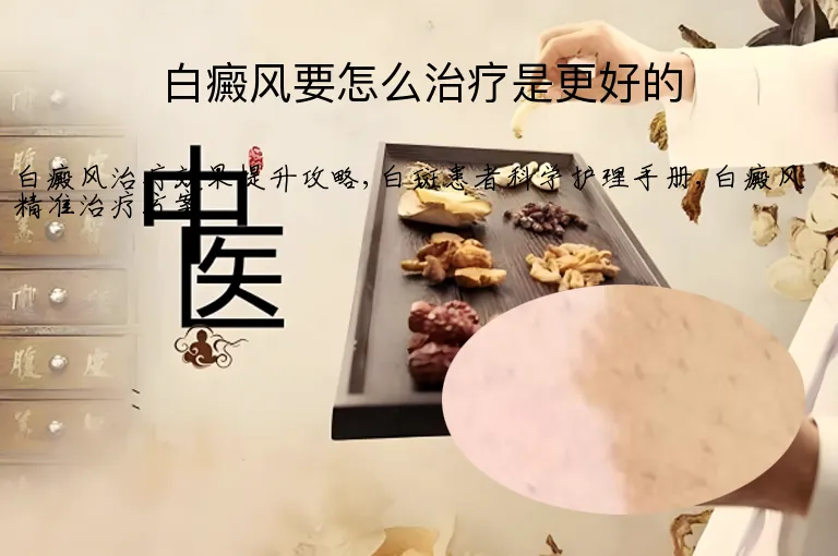 白癜风要怎么治疗是更好的