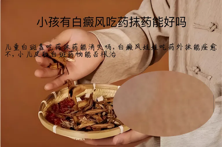 小孩有白癜风吃药抹药能好吗