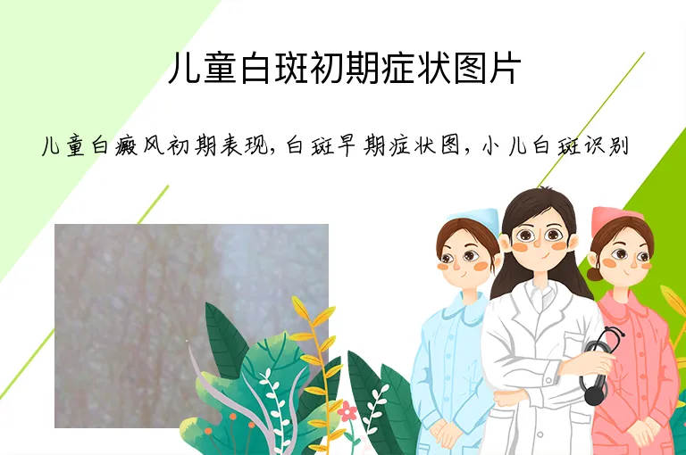 儿童白斑初期症状图片