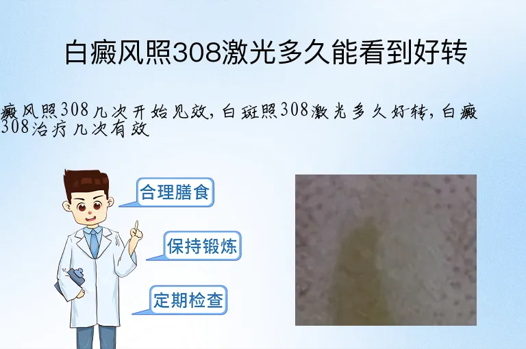 白癜风照308激光多久能看到好转