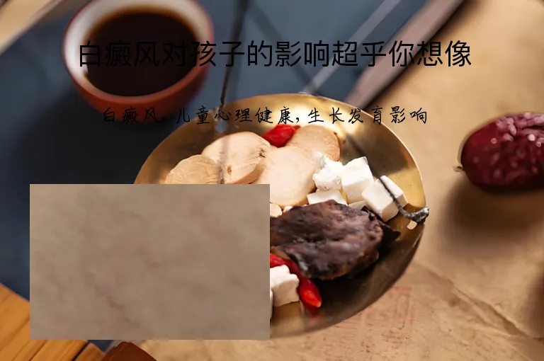 白癜风对孩子的影响超乎你想像
