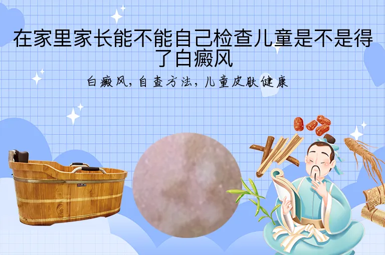 在家里家长能不能自己检查儿童是不是得了白癜风
