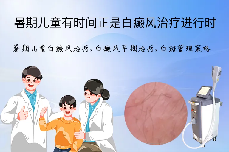 暑期儿童有时间正是白癜风治疗进行时