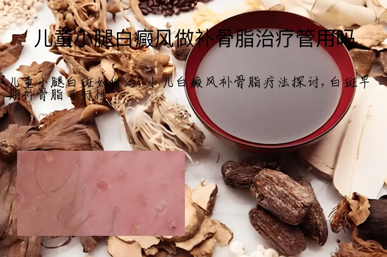 儿童小腿白癜风做补骨脂治疗管用吗