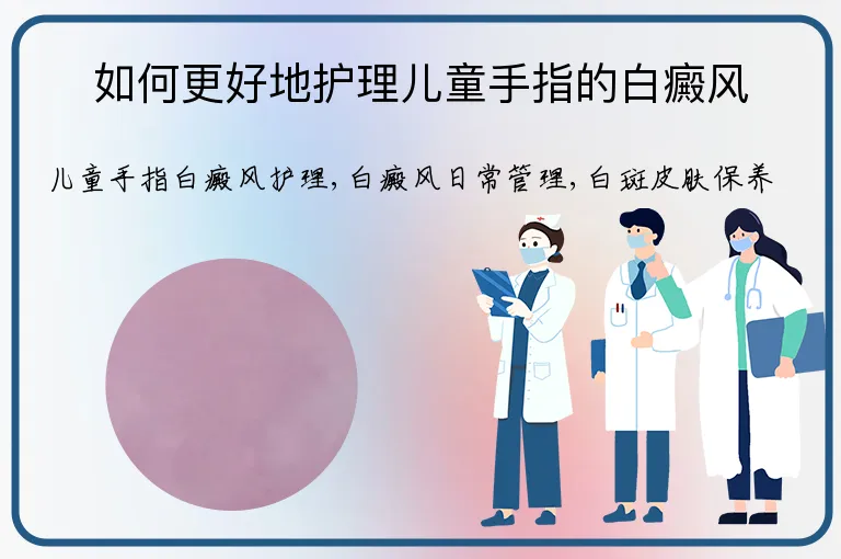 如何更好地护理儿童手指的白癜风