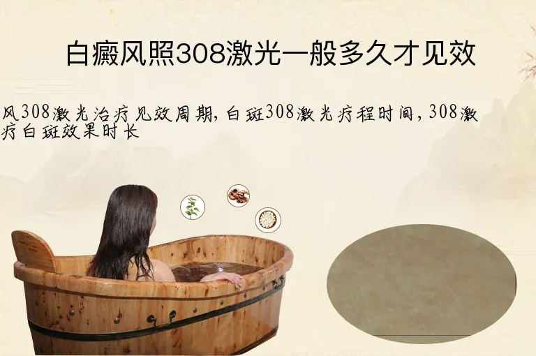 白癜风照308激光一般多久才见效
