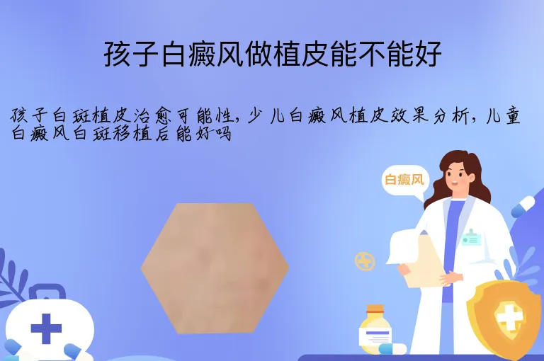 孩子白癜风做植皮能不能好