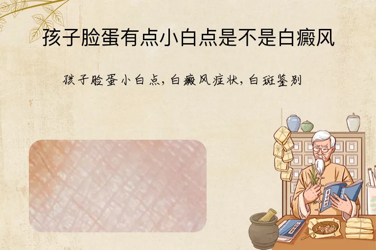 孩子脸蛋有点小白点是不是白癜风