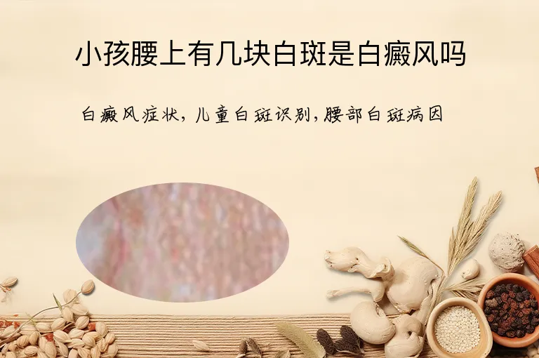 小孩腰上有几块白斑是白癜风吗