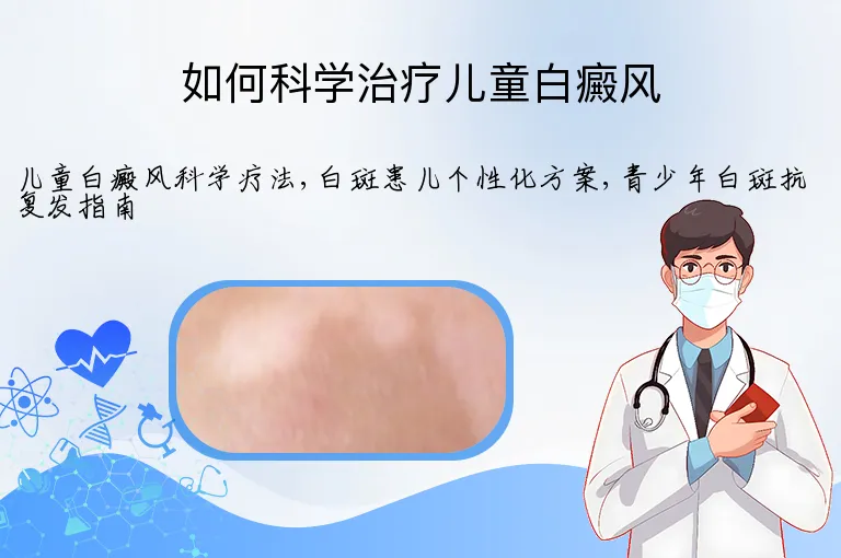 如何科学治疗儿童白癜风