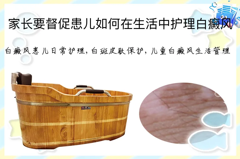 家长要督促患儿如何在生活中护理白癜风