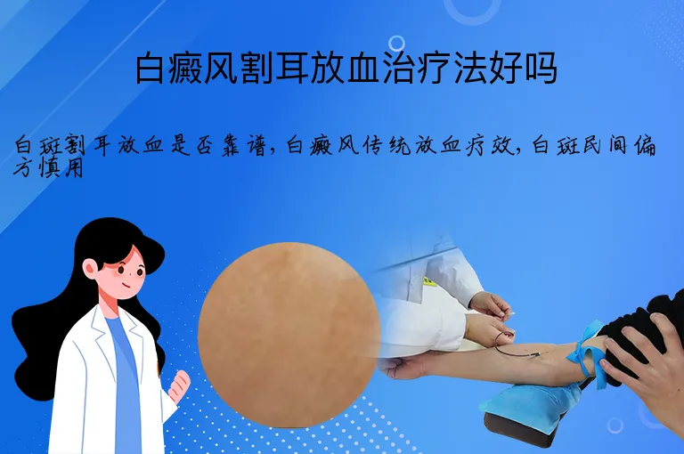 白癜风割耳放血治疗法好吗