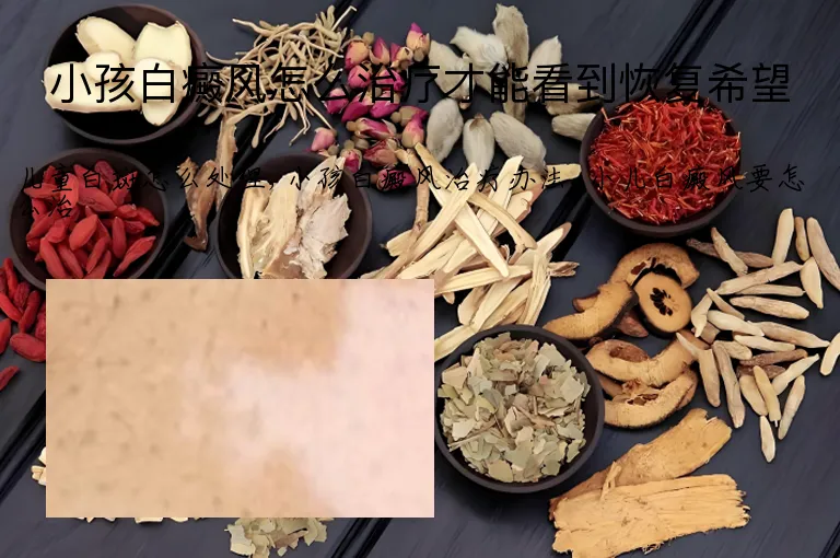 小孩白癜风怎么治疗才能看到恢复希望