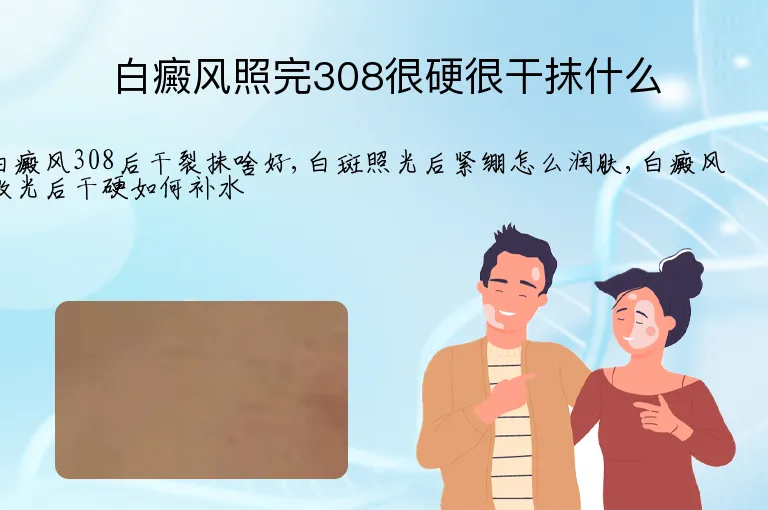 白癜风照完308很硬很干抹什么