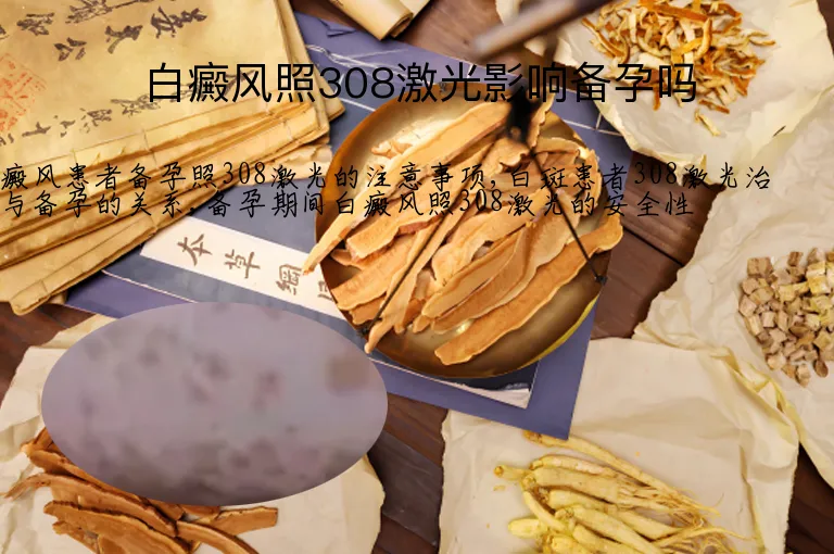 白癜风照308激光影响备孕吗