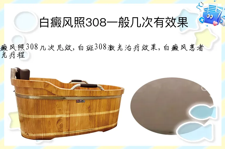 白癜风照308一般几次有效果