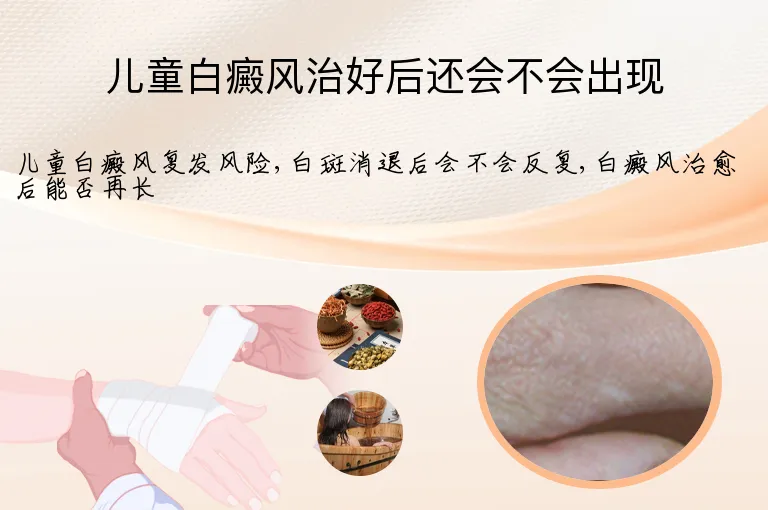 儿童白癜风治好后还会不会出现