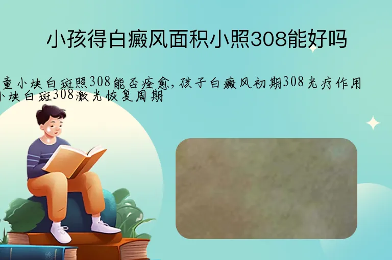 小孩得白癜风面积小照308能好吗