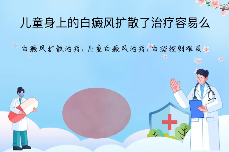 儿童身上的白癜风扩散了治疗容易么
