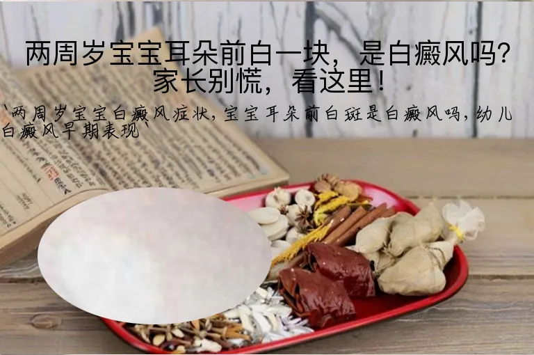 两周岁宝宝耳朵前白一块，是白癜风吗？家长别慌，看这里！