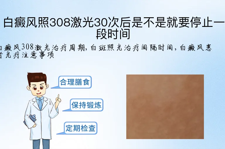 白癜风照308激光30次后是不是就要停止一段时间