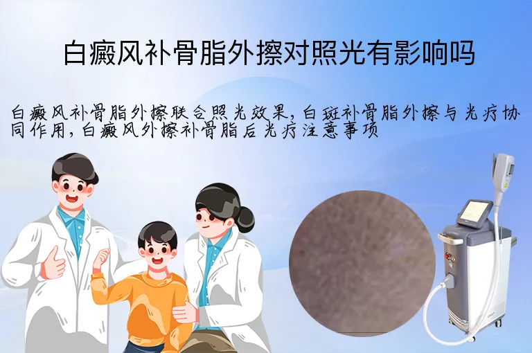 白癜风补骨脂外擦对照光有影响吗